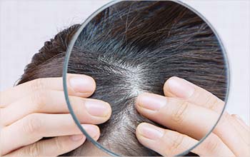 近年年齢に関係なく急増してきた女性の薄毛や抜け毛、実はそのほとんどがFAGAだと診断されています。